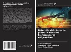 Обложка Detección del cáncer de próstata mediante biomarcadores epigenéticos