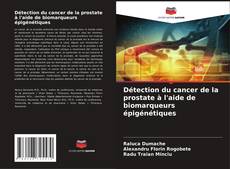Copertina di Détection du cancer de la prostate à l'aide de biomarqueurs épigénétiques