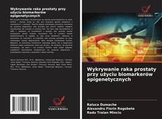 Copertina di Wykrywanie raka prostaty przy użyciu biomarkerów epigenetycznych