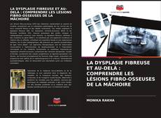 LA DYSPLASIE FIBREUSE ET AU-DELÀ : COMPRENDRE LES LÉSIONS FIBRO-OSSEUSES DE LA MÂCHOIRE的封面