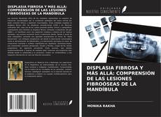 Capa do livro de DISPLASIA FIBROSA Y MÁS ALLÁ: COMPRENSIÓN DE LAS LESIONES FIBROÓSEAS DE LA MANDÍBULA 