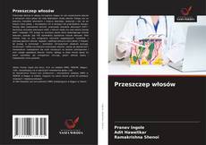 Copertina di Przeszczep włosów