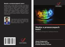 Capa do livro de Nauka o przeszczepach kości 
