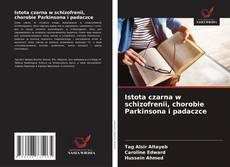 Couverture de Istota czarna w schizofrenii, chorobie Parkinsona i padaczce