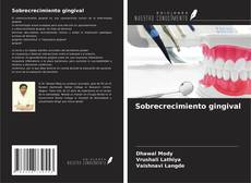 Capa do livro de Sobrecrecimiento gingival 