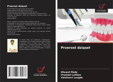 Couverture de Przerost dziąseł