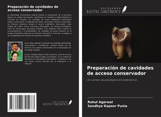 Buchcover von Preparación de cavidades de acceso conservador