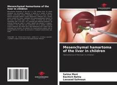 Buchcover von Mesenchymal hamartoma of the liver in children