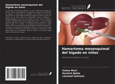 Buchcover von Hamartoma mesenquimal del hígado en niños