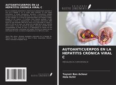 Copertina di AUTOANTICUERPOS EN LA HEPATITIS CRÓNICA VIRAL C