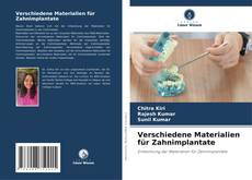 Copertina di Verschiedene Materialien für Zahnimplantate