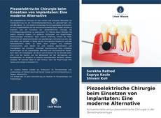 Обложка Piezoelektrische Chirurgie beim Einsetzen von Implantaten: Eine moderne Alternative
