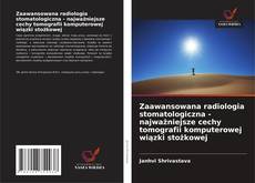 Zaawansowana radiologia stomatologiczna - najważniejsze cechy tomografii komputerowej wiązki stożkowej的封面