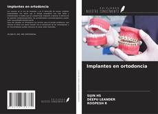 Capa do livro de Implantes en ortodoncia 