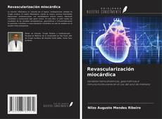 Buchcover von Revascularización miocárdica