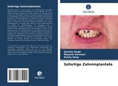 Sofortige Zahnimplantate的封面