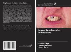 Buchcover von Implantes dentales inmediatos
