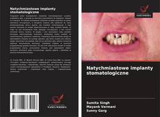 Portada del libro de Natychmiastowe implanty stomatologiczne