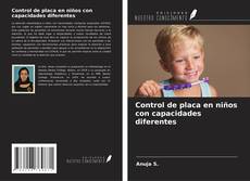 Buchcover von Control de placa en niños con capacidades diferentes