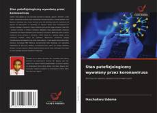 Couverture de Stan patofizjologiczny wywołany przez koronawirusa