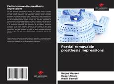 Copertina di Partial removable prosthesis impressions