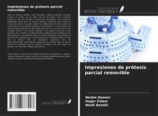Buchcover von Impresiones de prótesis parcial removible