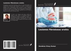 Buchcover von Lesiones fibroóseas orales