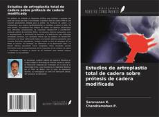 Buchcover von Estudios de artroplastia total de cadera sobre prótesis de cadera modificada
