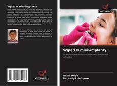 Wgląd w mini-implanty kitap kapağı
