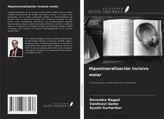 Buchcover von Hipomineralización incisivo molar