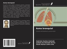 Buchcover von Asma bronquial