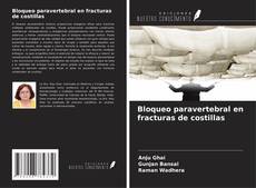 Buchcover von Bloqueo paravertebral en fracturas de costillas