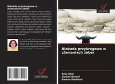 Buchcover von Blokada przykręgowa w złamaniach żeber