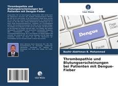 Bookcover of Thrombopathie und Blutungserscheinungen bei Patienten mit Dengue-Fieber