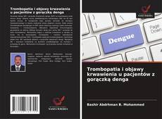 Buchcover von Trombopatia i objawy krwawienia u pacjentów z gorączką denga