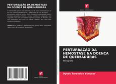 Capa do livro de PERTURBAÇÃO DA HEMOSTASE NA DOENÇA DE QUEIMADURAS 