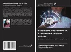 Buchcover von Rendimiento funcional tras un ictus mediante imágenes motoras