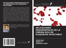Copertina di APLICACIONES PERIODONTALES DE LA FIBRINA RICA EN PLAQUETAS INYECTABLE