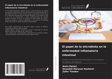 Copertina di El papel de la microbiota en la enfermedad inflamatoria intestinal