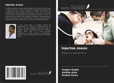 Buchcover von Injertos óseos