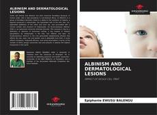 Bookcover of ALBINISM AND DERMATOLOGICAL LESIONS