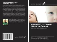 Buchcover von ALBINISMO Y LESIONES DERMATOLÓGICAS