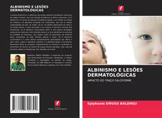 Bookcover of ALBINISMO E LESÕES DERMATOLÓGICAS