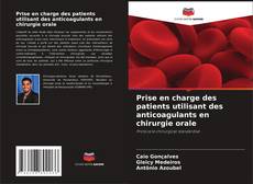 Capa do livro de Prise en charge des patients utilisant des anticoagulants en chirurgie orale 