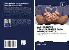 Couverture de ALINHADORES TRANSPARENTES PARA DENTIÇÃO MISTA
