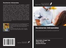 Buchcover von Escáneres intraorales