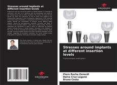 Stresses around implants at different insertion levels的封面