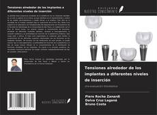 Buchcover von Tensiones alrededor de los implantes a diferentes niveles de inserción