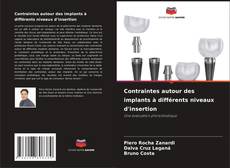 Contraintes autour des implants à différents niveaux d'insertion的封面