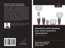 Couverture de Naprężenia wokół implantów przy różnych poziomach wprowadzenia